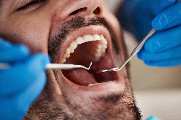 Best Emergency Dental Services for Seniors in Philipsburg, MT